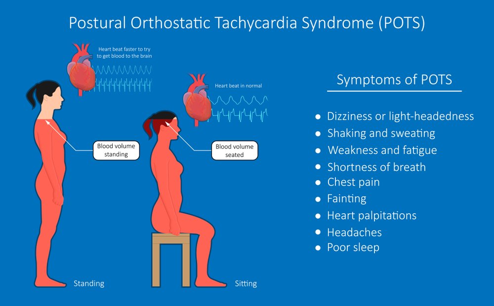 What Is Syncope And Orthostatic Hypotension Syncope And Orthostatic
