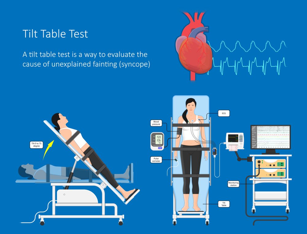 what-is-syncope-orthostatic-hypotension-syncope-and-orthostatic