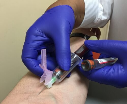 Venipuncture using a BD Vacutainer