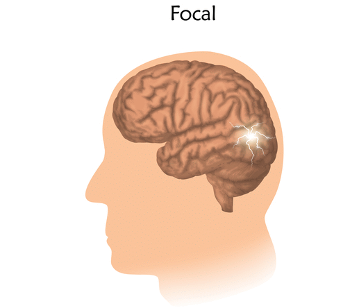 Focal Seizure meaning in Marathi