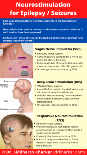 Neurostimulation for Epilepsy or Seizures