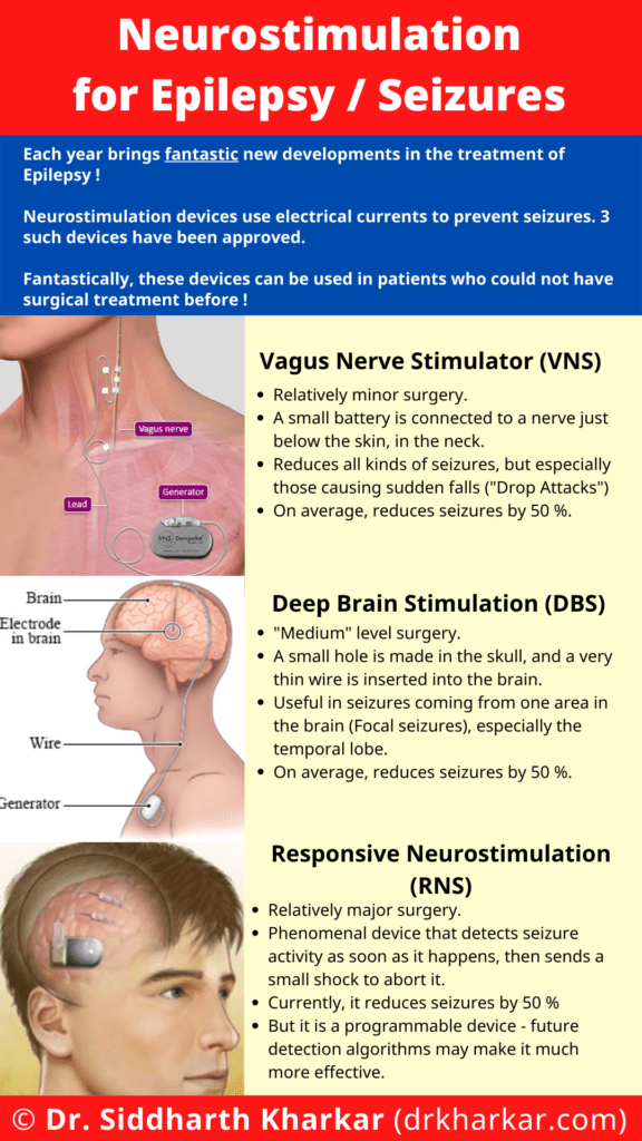 Neuromodulation / Neurostimulation For Epilepsy, Emerging Trends In ...