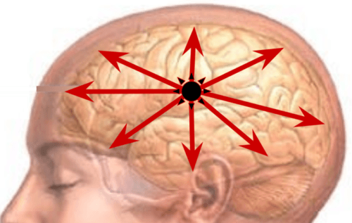 How a seizure spreads in the brain