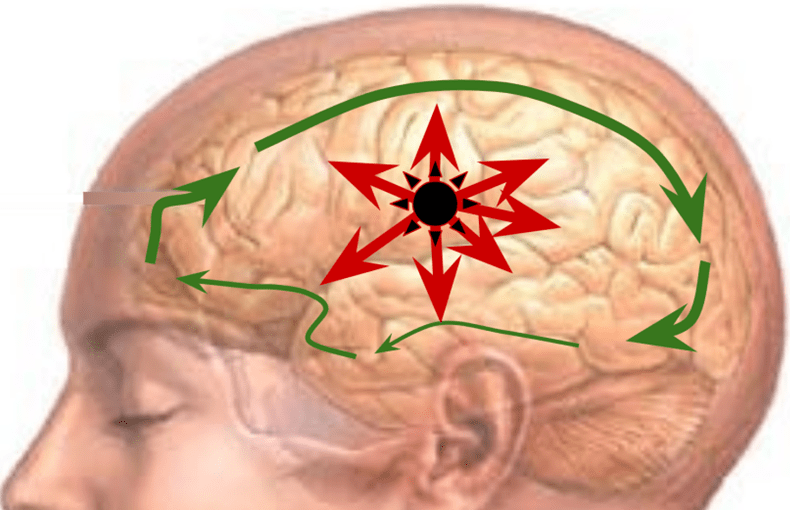 How a seizure starts in the brain