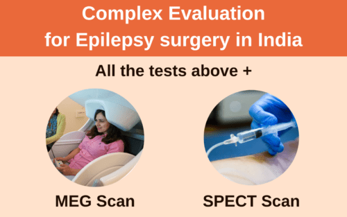 Complex Evaluation of Epilepsy surgery cost in India