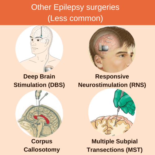 Other types of Epilepsy surgery in India